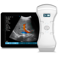 Ultrasound